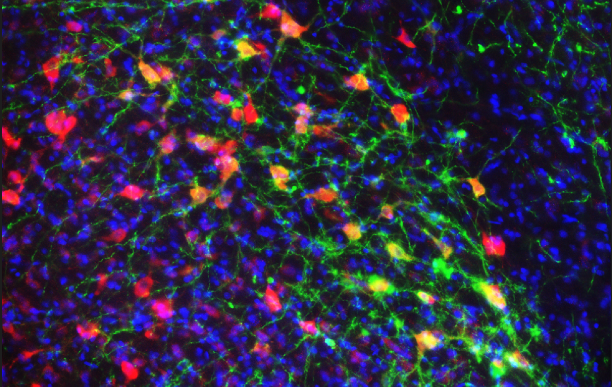 Cholinergic Interneurons