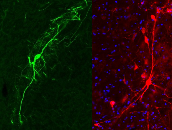 Cholinergic Interneurons